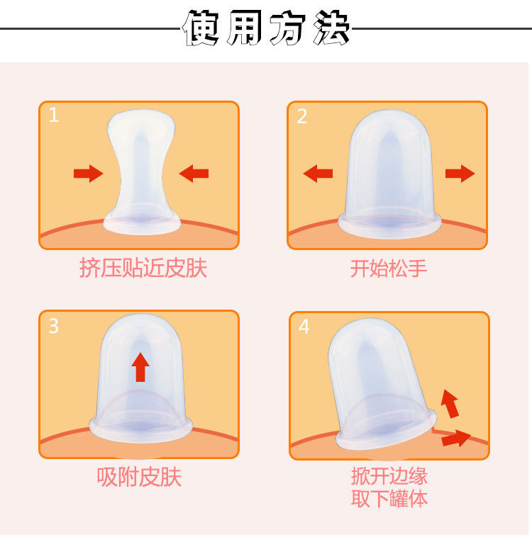 2号硅胶拔火罐 2号硅胶拔火罐
